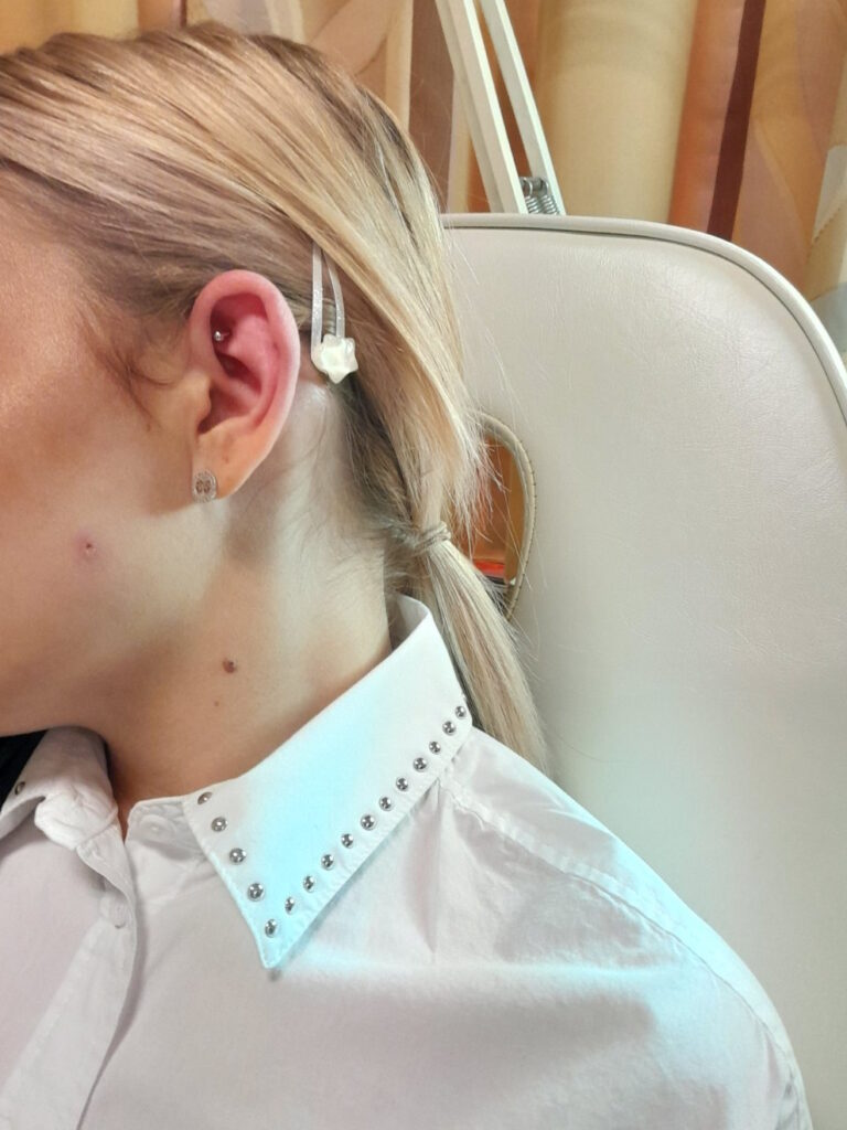 Shen-Men-piercing - Medica Naturna Életmódcentrum